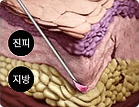pds lvup11 build option 1169932464017374466621 — 레벨업의원